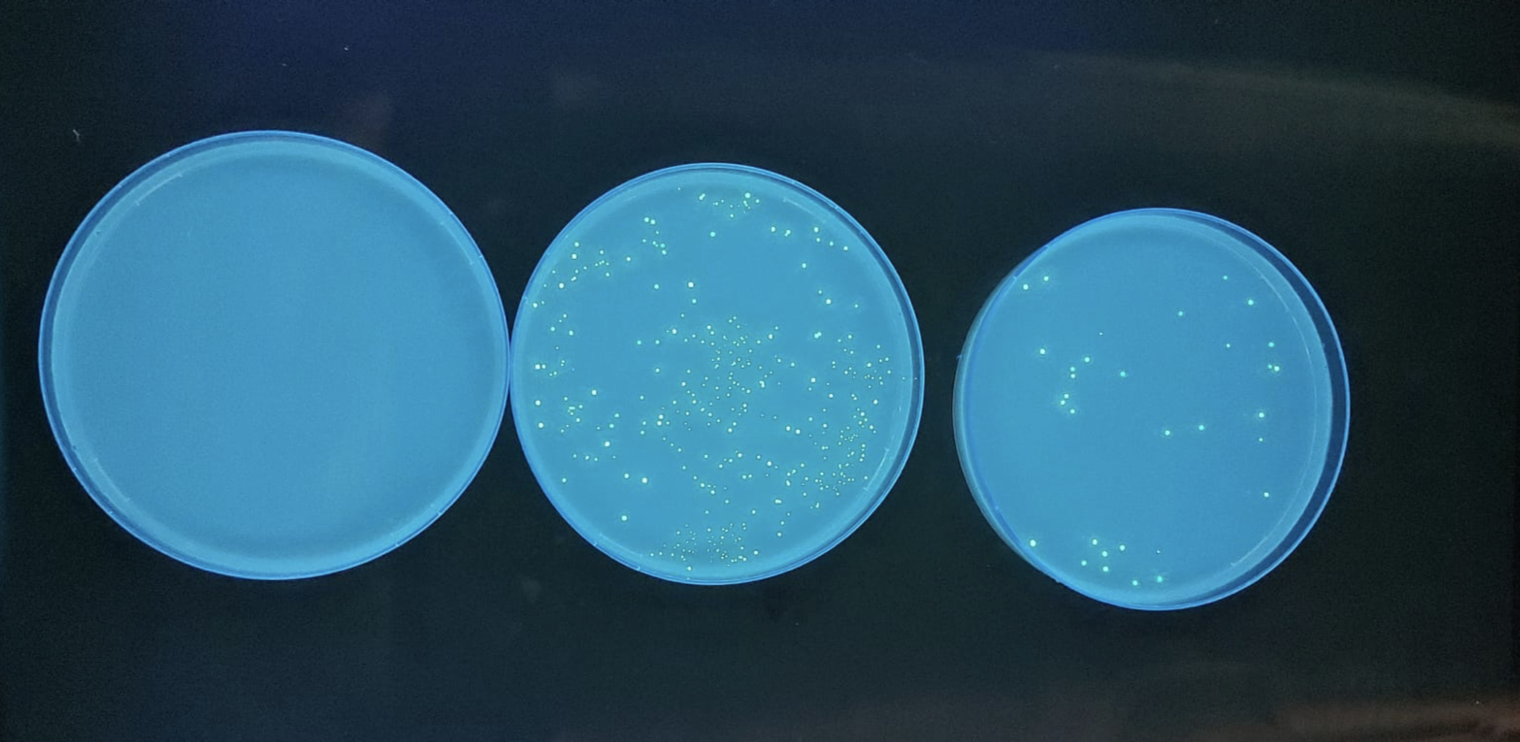 GFP gene plasmid transformation